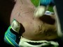 Após dividida, Marcelo Grohe sofre corte profundo no joelho esquerdo