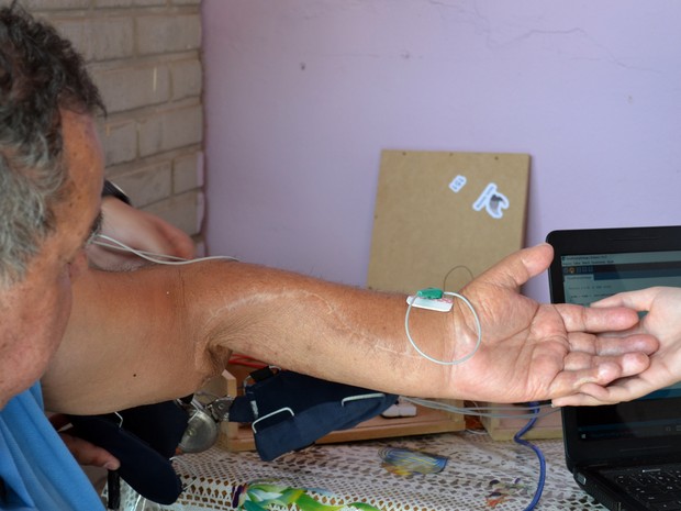 'Braço biônico', José Sebastião Carneiro, Zé da Guarda, Fetin, Inatel, Santa Rita do Sapucaí (Foto: Daniela Ayres/G1)