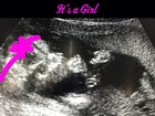 Kevin Jonas anuncia sexo do seu primeiro filho: 'É uma menina'