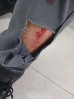Calça de policial ficou rasgada após suspeito dar socos e chutes em Praia Grande (Foto: G1)