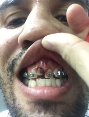 Léo Santos UFC (Foto: Reprodução / Instagram)