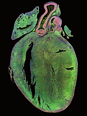 Coração de rato recém-nascido tratado com microRNA, capaz de promover a proliferação (em vermelho) das células cardíacas  (Foto: Eulalio et al/Reprodução)