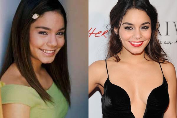 Vanessa Hudgens (Foto: Divulgação e Getty Images)