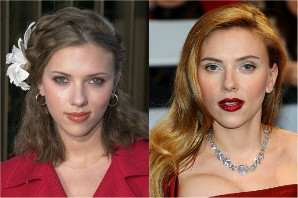 A cirurgia que a atriz Scarlett Johansson fez no nariz é uma das mais elogiadas (ou menos criticadas) do show business. (Foto: Getty Images)