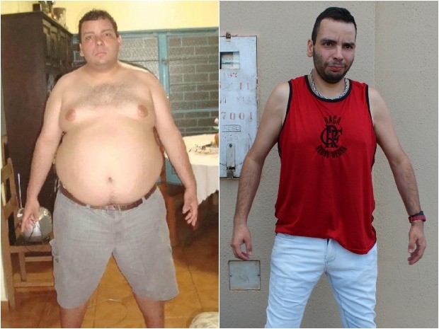 Homem perde 65 kg após cirurgia bariátrica (Foto: Arquivo Pessoal/Alex Ferreira Machado e Glaucea Vaccari/G1 MS)