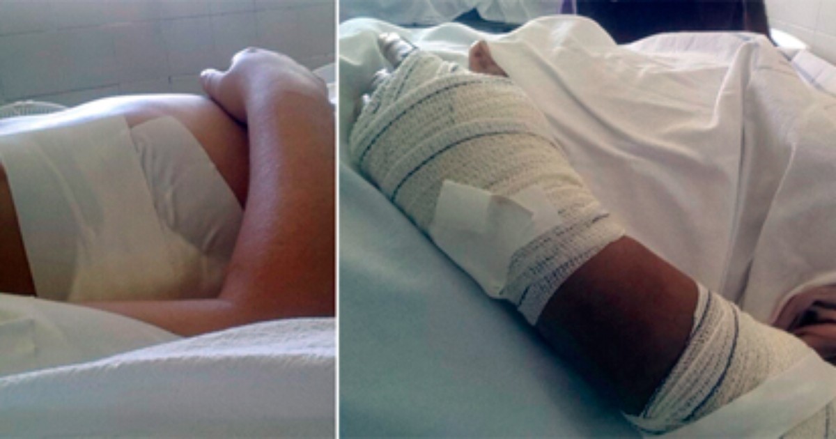 Avó e neta atacadas com golpes de facão se recuperam bem, diz ... - Globo.com