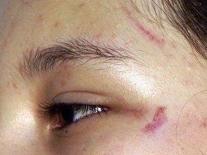Adolescente é agredida por alunas e pai promete tirar filha de escola ...