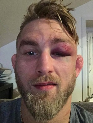 Rosto Alexander Gustafsson UFC (Foto: Reprodução / Facebook) Rosto Alexander Gustafsson UFC (Foto: Reprodução / Facebook)