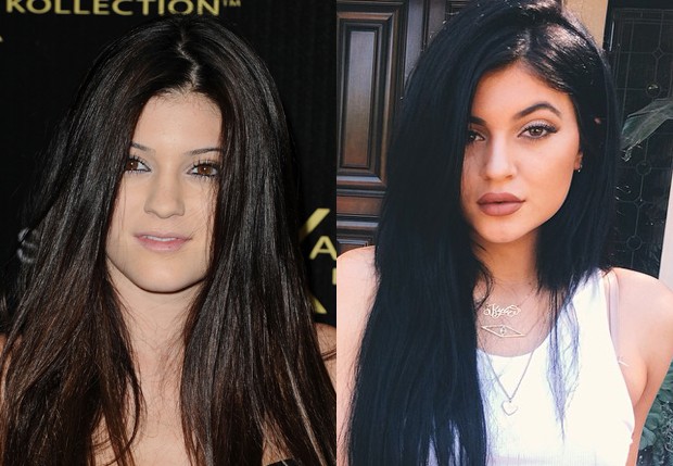 Kylie Jenner em 2011 e em 2014 (Foto: getty Images e Reprodução/Instagram)