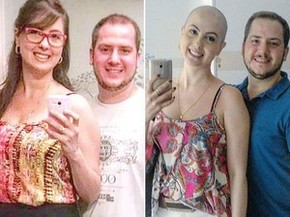 Roberta ao lado do marido antes e depois do tratamento (Foto: Arquivo Pessoal) Roberta ao lado do marido antes e depois do tratamento (Foto: Arquivo Pessoal)