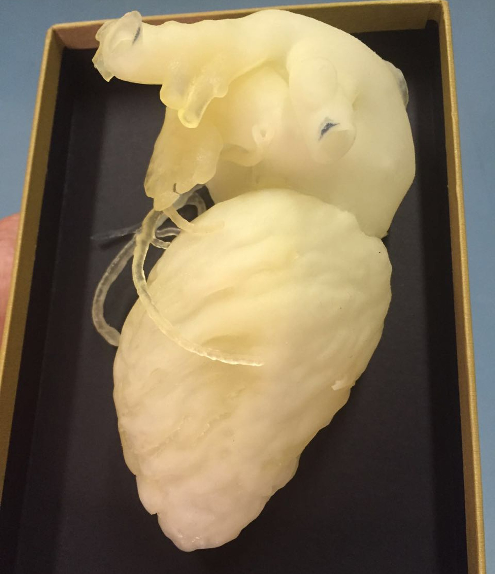 Biomodelo impresso em 3D reproduz em detalhes a anatomia do órgão do paciente (Foto: Leila Nogueira e Luiz Antonio Rivetti/Divulgação)