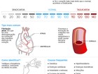 Sopro e arritmia podem ocorrer em qualquer idade; veja como prevenir