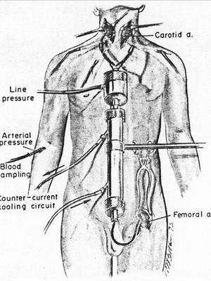 Um diagrama da técnica usada por White na década de 1970. O macaco que teve a cabeça transplantada sobreviveu por oito dias (Foto: reprodução)