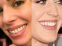 Ana Furtado posta foto com dente sujo e se compara a Katy Perry