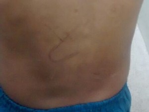 As crianças foram submetidas a exames traumatológicos, cujo laudo deve sair em até sete dias. (Foto: Divulgação/ Polícia Civil)