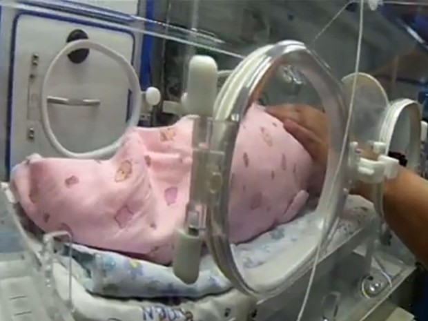 O bebê fez uma tomografia e ainda não é possível saber se teve alguma complicação (Foto: Reprodução/TV Tem)