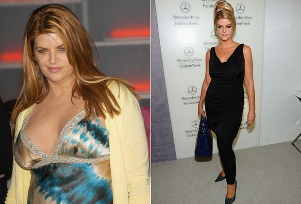 Kristie Alley (Foto: Grosby Group e Getty Images)