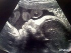 Piqué posta foto do ultrassom do primeiro filho com Shakira