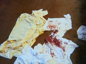 Agentes fotografaram lençóis sujos de sangue, após agressão (Foto: Paulo Souza/EPTV)