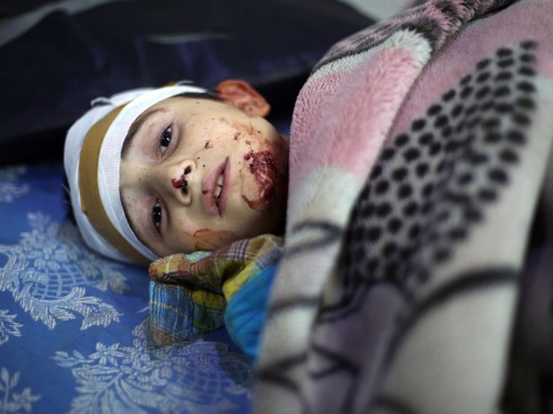 Menino sírio ficou ferido nesta segunda-feira (9) após ataque do governo contra áreas dominadas por rebeldes na região de Ghouta, nos arredores de Damasco (Foto: Amer Almohibany / AFP)