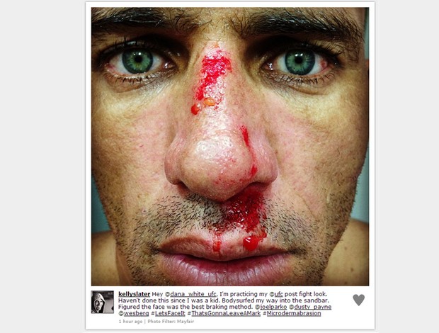 Kelly Slater nariz ferido sangue  (Foto: Reprodução / Instagram)