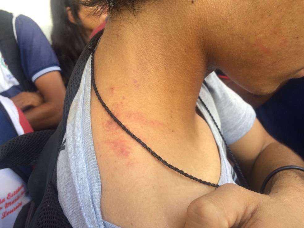 Estudante diz que foi agredido pela PM durante protesto em Maceió (Foto: Michelle Farias/G1)