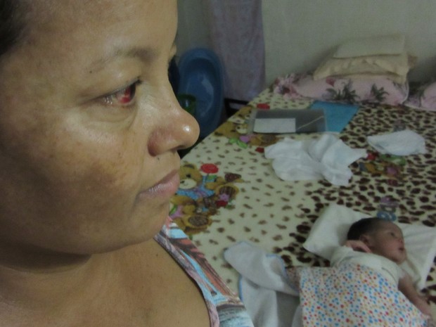 Angela Aparecida Gomes de Sousa e o bebê Bernardo; criança teve o braço fraturado durante o parto em Brasília (Foto: Alexandre Bastos/G1)