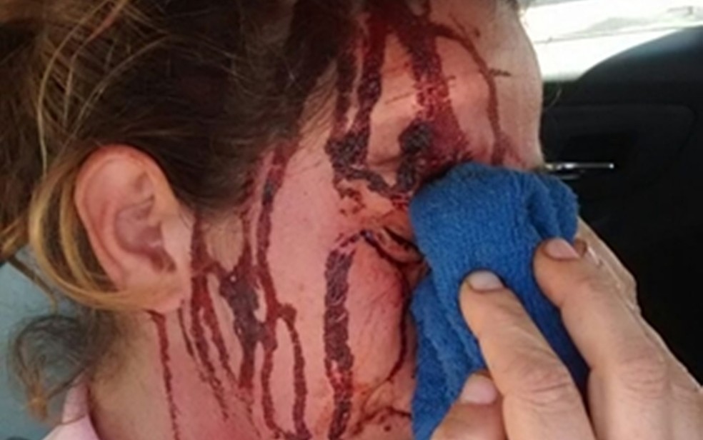 Mulher com rosto ensanguentado após agressão de parceiro em Itapetininga, São Paulo (Foto: Divulgação/Polícia Militar)