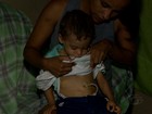 Cirurgias pediátricas são suspensas em Maceió por falta de pagamento
