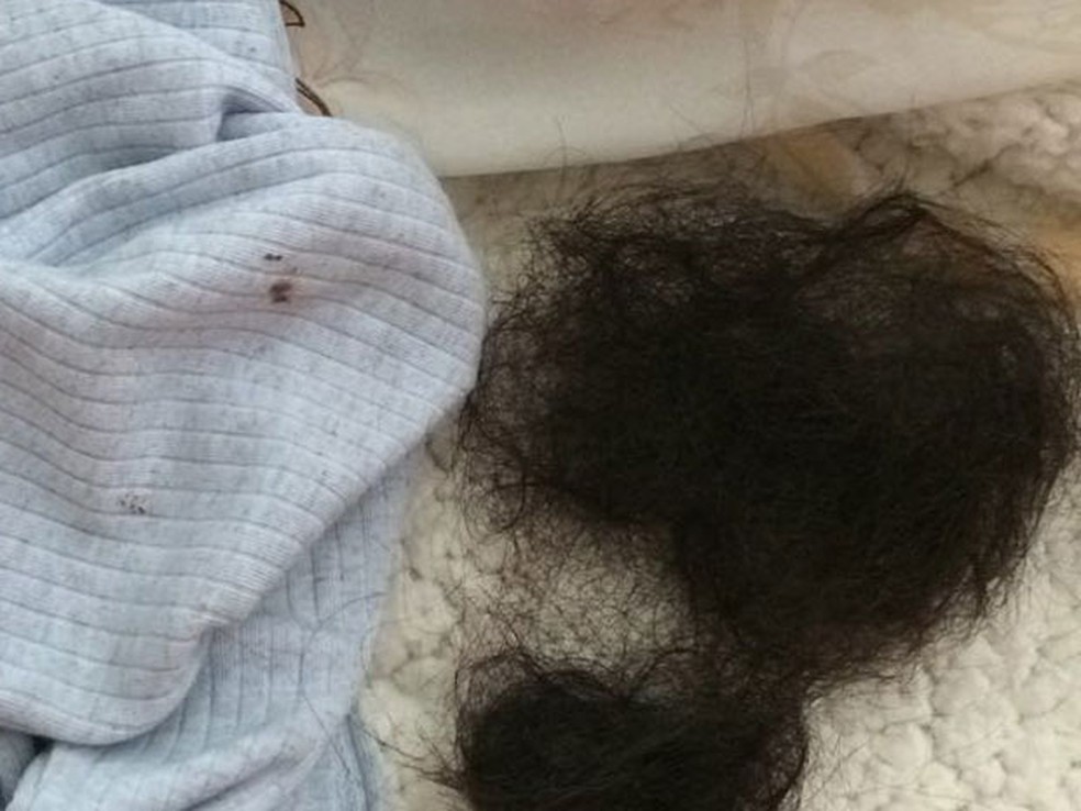 Jéssica diz ter tido o cabelo arrancado e Hugo afirma que ela puxou o próprio cabelo (Foto: Arquivo pessoal )