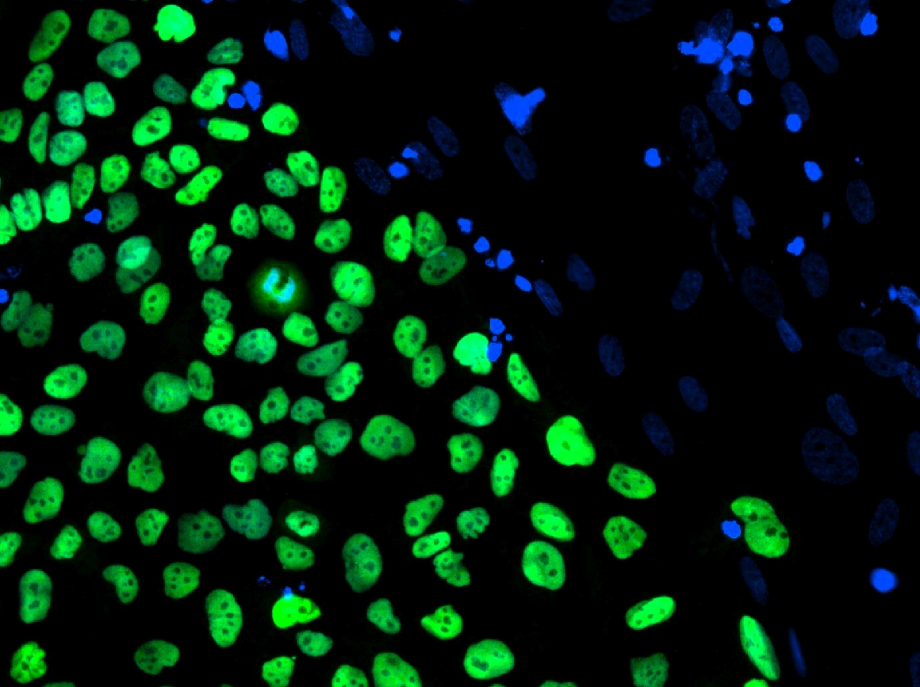 célula 2 (Foto: Julie Baker/Stanford University School of Medicine/California Institute for Regenerative Medicine/Handout/Reuters)
