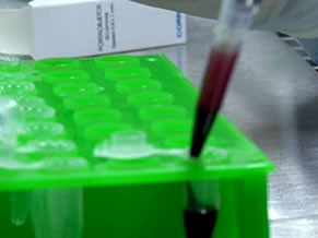 Diagnóstico precoce é essencial para o tratamento da Aids (Foto: Divulgação de TV) Diagnóstico precoce é essencial para o tratamento da Aids (Foto: Divulgação de TV)