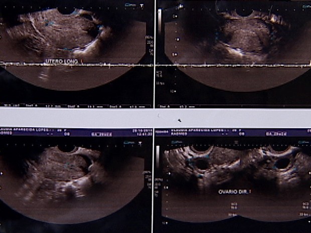 Ultrassom mostra ausência de feto, diz médico (Foto: Reprodução/TV Integração)