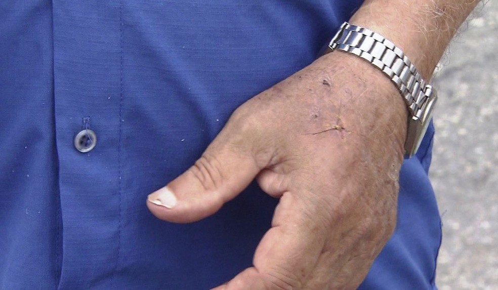Aposentado procurou atendimento após ser mordido por cachorro em Santos (Foto: Reprodução/TV Tribuna)