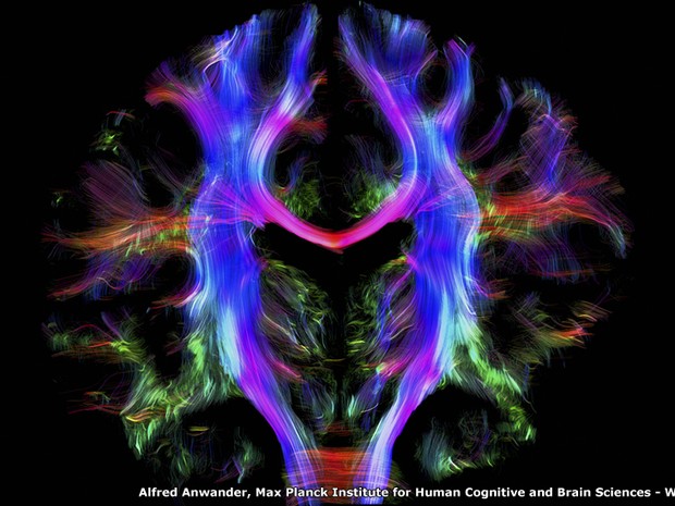 Um caleidoscópio de cores mostra um mapa dos caminhos dentro do cérebro de um jovem adulto e saudável. Partes diferentes do cérebro se comunicam com outras através de fibras nervosas. Usando uma técnica ligada a ressonância magnética, a imagem foi criada  (Foto: Alfred Anwander, Max Planck Institute for Human Cognitive and Brain Sciences)