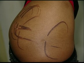Jovem E Marcada Com Ferro Quente Pelo Namorado No Es Diz Mae Espirito Santo G1