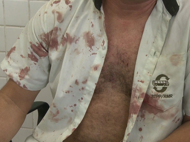 Ferimentos deixaram camisa do motorista ensanguentada.  (Foto: Reprodução / TV Globo)