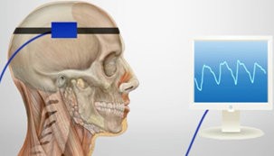 Equipamento permite monitorar a pressão intracraniana sem cirurgia (Foto: Divulgação)