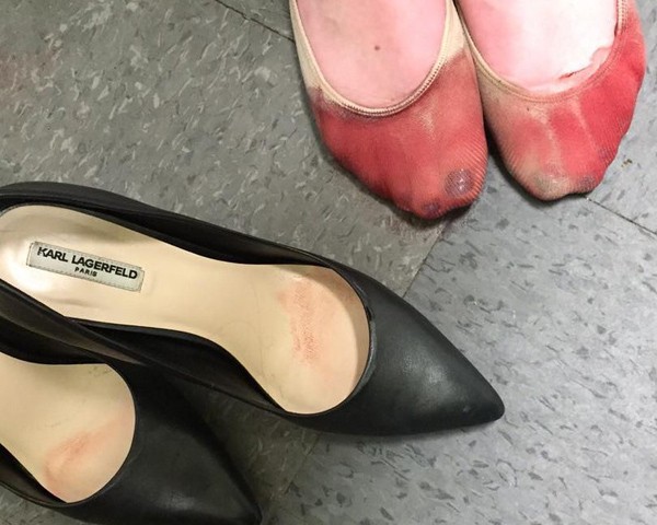 A britânica Nicola Gavins publicou no Facebook as fotos dos pés ensanguentados de uma amiga, que trabalha como garçonete no Canadá (Foto: Reprodução Facebook)