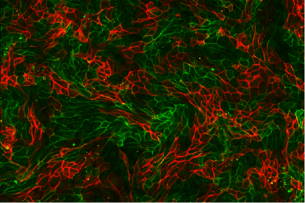Células renais em imagem de microscópio (Foto: Alex Ritter, Jennifer Lippincott Schwartz and Gillian Griffiths/National Institutes of Health)
