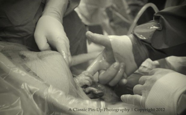 Momento que Nevaeh dedo do médico ao nascer foi registrado pelo marido de Alicia (Foto: Reprodução)