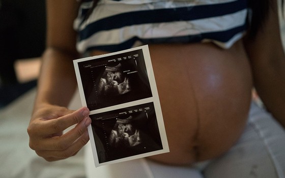  Grávida de seis meses mostra ultrassom em hospital de Pernambuco. Aos 18 anos, ela contraiu zika e mostra exames normais do bebê (Foto: AP Photo/Felipe Dana)
