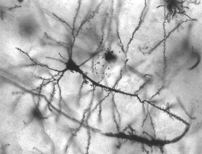 Neurônios (Foto: Wikimedia Commons )