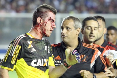 Paulo Victor, do flamengo, sangue no jogo contra o macaé (Foto: Tiago Ferreira / Macaé Esporte)
