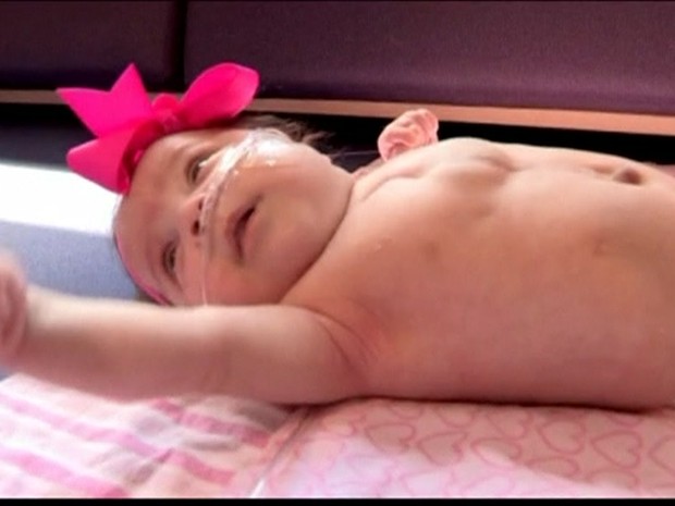 Um bebê que nasceu com parte do coração batendo fora do corpo deixou o hospital (Foto: BBC)