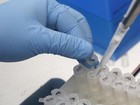 Vacina contra vírus da zika se mostra promissora em ratos, diz laboratório