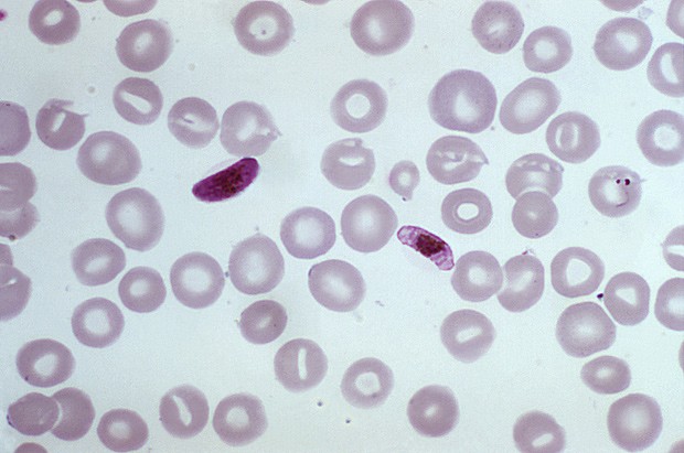  Parasitas da malária são vistos entre hemácias do sangue  (Foto: CDC/Mae Melvin)
