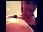 Jennifer Lopez se apresenta em Miami e mostra corte no joelho
