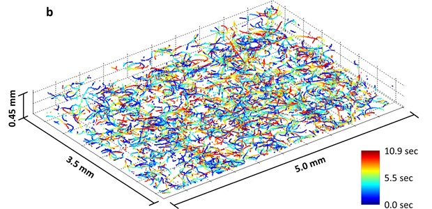 Espermatozoides (Foto: Ozcan Research Group at UCLA/Divulgação)