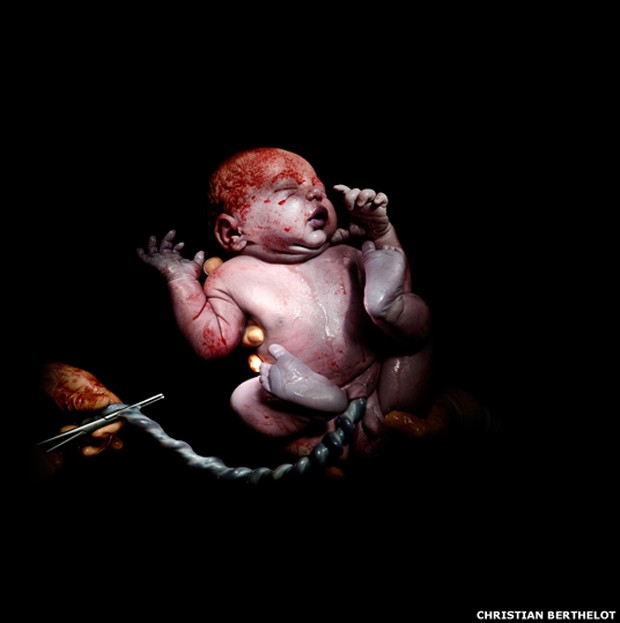 Kevin, nascido no dia 27 de dezembro de 2013, 4,366 quilos, 13 segundos depois do nascimento (Foto: Christian Berthelot) Kevin, nascido no dia 27 de dezembro de 2013, 4,366 quilos, 13 segundos depois do nascimento (Foto: Christian Berthelot)